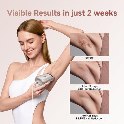 Laser Hair Removal Device